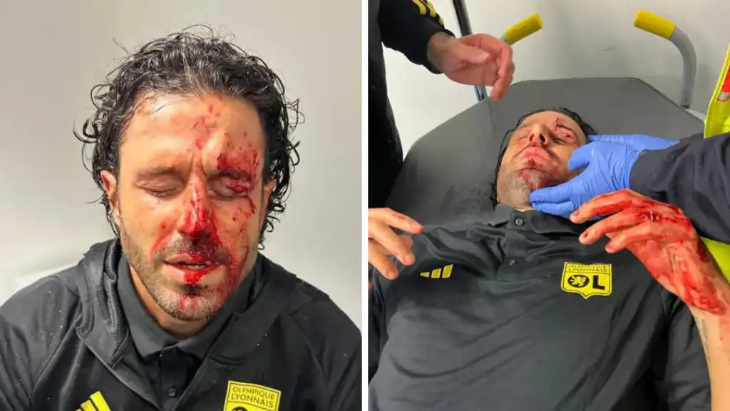 Fabio Grosso was attacked with stones